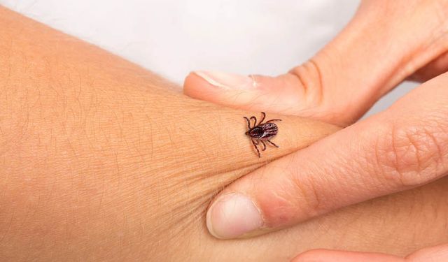 Kene Isırması: Ne yapmalı ve kene  nasıl çıkarılır ?